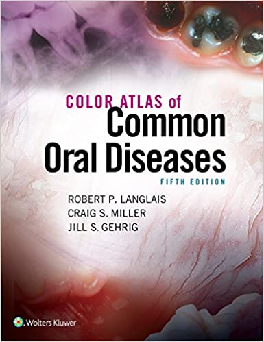 Color Atlas of Common Oral Diseases (5th Edition) - Pdf